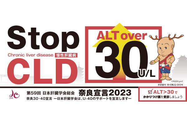 日本肝臓学会、初となる市民・非専門医向け宣言を発出／ALT＞30で